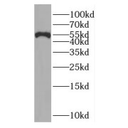 WB analysis of Jurkat cells, using RAD23A antibody (1/500 dilution).