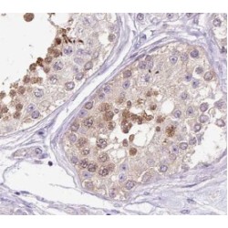 RAD51 Recombinase (RAD51) Antibody