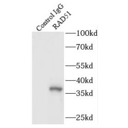 RAD51 Recombinase (RAD51) Antibody