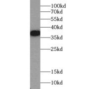 WB analysis of HeLa cells, using RAD51 antibody (1/1000 dilution).