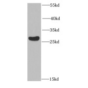 WB analysis of HeLa cells, using RAD9A antibody (1/1000 dilution).