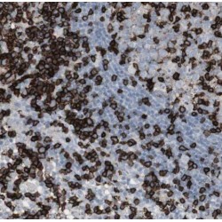 Recombination Activating Gene 2 (RAG2) Antibody