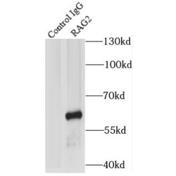 Recombination Activating Gene 2 (RAG2) Antibody