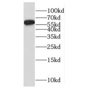 WB analysis of A375 cells, using RAG2 antibody (1/300 dilution).