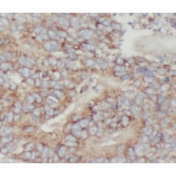 RAIDD Antibody