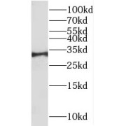 WB analysis of human brain tissue, using RALYL antibody (1/800 dilution).