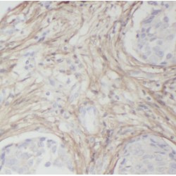 Receptor Activity Modifying Protein 2 (RAMP2) Antibody