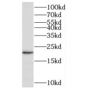 WB analysis of mouse brain tissue, using RAMP2 antibody (1/400 dilution).