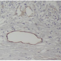 Receptor Activity Modifying Protein 3 (RAMP3) Antibody