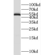 WB analysis of mouse heart tissue, using RAMP3 antibody (1/500 dilution).