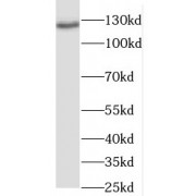 WB analysis of HEK-293 cells, using RANBP6 antibody (1/200 dilution).