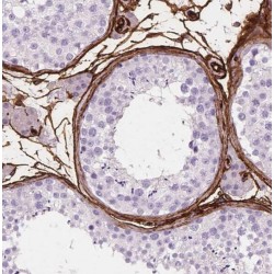 RAN Binding Protein 9 (RANBP9) Antibody