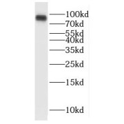 WB analysis of mouse brain tissue, using RANBP9 antibody (1/600 dilution).