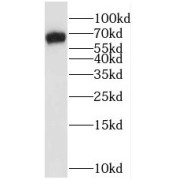 WB analysis of SKOV-3 cells, using RAPH1 antibody (1/600 dilution).