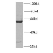 WB analysis of HeLa cells, using RAPSN antibody (1/1000 dilution).