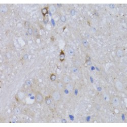 Retinoic Acid Receptor Alpha (RARA) Antibody