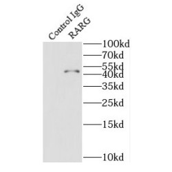 Retinoic Acid Receptor Gamma (RARG) Antibody