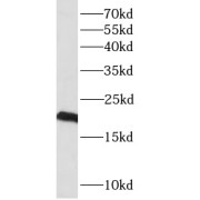 WB analysis of Transfected HEK-293 cells, using RARRES3 antibody (1/1000 dilution).