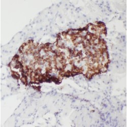 RAS And EF-Hand Domain Containing (RASEF) Antibody