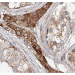 Ras GTPase Activating Protein (RASGAP) Antibody