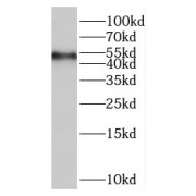 WB analysis of mouse kidney tissue, using RASGRP2 antibody (1/300 dilution).