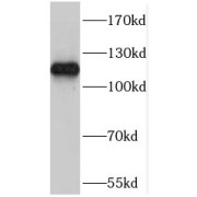 WB analysis of mouse lung tissue, using RASIP1 antibody (1/300 dilution).