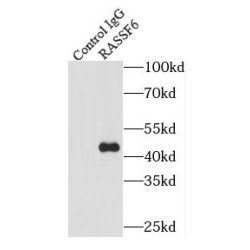 Ras Association Domain-Containing Protein 6 (RASSF6) Antibody