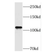 WB analysis of HT-1080 cells, using Rb antibody (1/500 dilution).