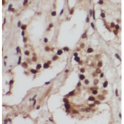 Retinoblastoma Protein 1 (RB1) Antibody