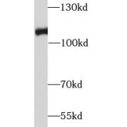 WB analysis of Jurkat cells, using RB1 antibody (1/3000 dilution).
