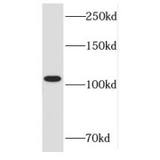 WB analysis of Jurkat cells, using RB1 antibody (1/3000 dilution).