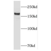 WB analysis of HeLa cells, using RB1CC1 antibody (1/1000 dilution).