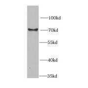 WB analysis of HeLa cells, using RBBP5 antibody (1/1000 dilution).