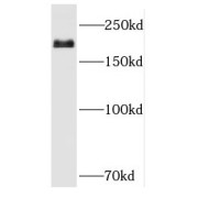 WB analysis of HEK-293 cells, using RBBP6 antibody (1/400 dilution).