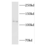 WB analysis of human brain tissue, using RBM10 antibody (1/1000 dilution).