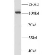 WB analysis of HEK-293 cells, using RBM15 antibody (1/1000 dilution).