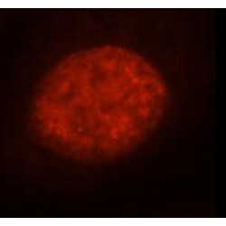 RNA Binding Motif Protein 15 (RBM15) Antibody