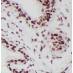 RNA Binding Motif Protein 15 (RBM15) Antibody