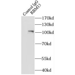 RNA Binding Motif Protein 15 (RBM15) Antibody