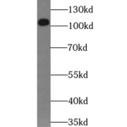 WB analysis of HeLa cells, using RBM15 antibody (1/1000 dilution).