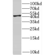 WB analysis of HeLa cells, using RBM17 antibody (1/3000 dilution).