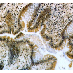 RNA Binding Motif Protein 19 (RBM19) Antibody