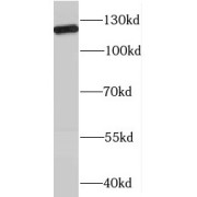 WB analysis of mouse colon tissue, using RBM19 antibody (1/300 dilution).