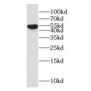 WB analysis of Raji cells, using RBM22 antibody (1/1000 dilution).