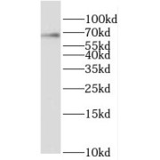 WB analysis of HepG2 cells, using RBM42 antibody (1/500 dilution).