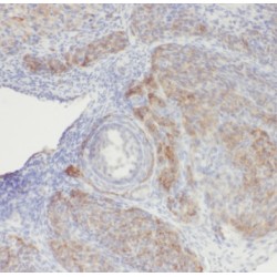 RBM8A,Y14 Antibody