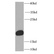 WB analysis of human plasma tissue, using RBP4 antibody (1/1000 dilution).