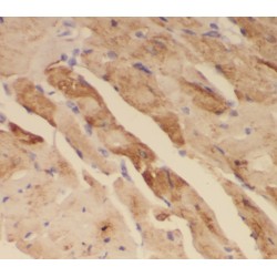 Ring-Box 1 (RBX1) Antibody