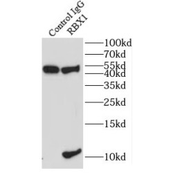 Ring-Box 1 (RBX1) Antibody