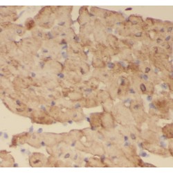 Calcipressin-1 (RCAN1) Antibody